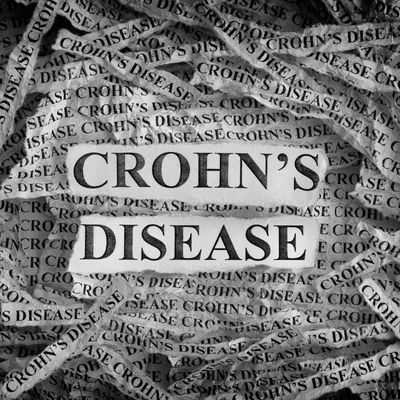 La enfermedad de Crohn